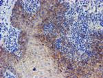 ERBB2 Antibody in Immunohistochemistry (Paraffin) (IHC (P))