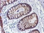 ERBB2 Antibody in Immunohistochemistry (Paraffin) (IHC (P))