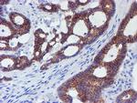 ERBB2 Antibody in Immunohistochemistry (Paraffin) (IHC (P))