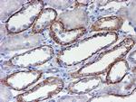 ERBB2 Antibody in Immunohistochemistry (Paraffin) (IHC (P))