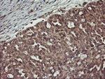 ERBB2 Antibody in Immunohistochemistry (Paraffin) (IHC (P))