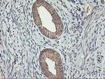 ERBB2 Antibody in Immunohistochemistry (Paraffin) (IHC (P))