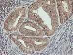 ERBB2 Antibody in Immunohistochemistry (Paraffin) (IHC (P))