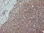 ERBB2 Antibody in Immunohistochemistry (Paraffin) (IHC (P))