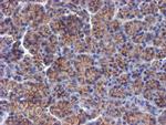 ERBB2 Antibody in Immunohistochemistry (Paraffin) (IHC (P))