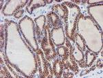 ERBB2 Antibody in Immunohistochemistry (Paraffin) (IHC (P))