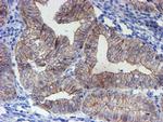 ERBB2 Antibody in Immunohistochemistry (Paraffin) (IHC (P))