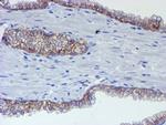 ERBB2 Antibody in Immunohistochemistry (Paraffin) (IHC (P))