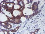 ERBB2 Antibody in Immunohistochemistry (Paraffin) (IHC (P))