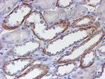 ERBB2 Antibody in Immunohistochemistry (Paraffin) (IHC (P))