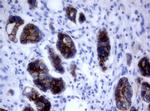 ERBB2 Antibody in Immunohistochemistry (Paraffin) (IHC (P))