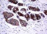 ERBB2 Antibody in Immunohistochemistry (Paraffin) (IHC (P))