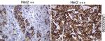 ERBB2 Antibody in Immunohistochemistry (Paraffin) (IHC (P))