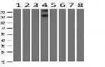 ERBB2 Antibody in Western Blot (WB)