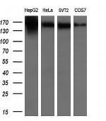 ERBB2 Antibody in Western Blot (WB)