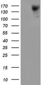 ERBB2 Antibody in Western Blot (WB)