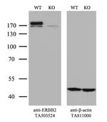 ERBB2 Antibody in Western Blot (WB)
