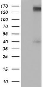 ERBB2 Antibody in Western Blot (WB)