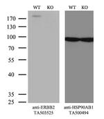 ERBB2 Antibody in Western Blot (WB)