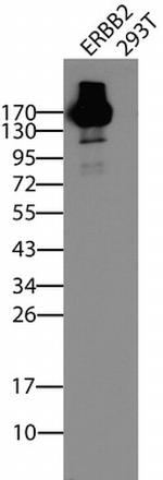 ERBB2 Antibody in Western Blot (WB)