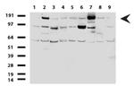 ERBB2 Antibody in Western Blot (WB)