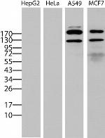 ERBB2 Antibody in Western Blot (WB)