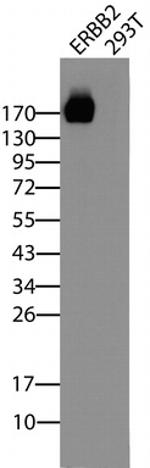 ERBB2 Antibody in Western Blot (WB)