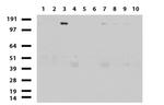 ERBB2 Antibody in Western Blot (WB)