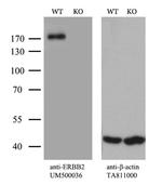 ERBB2 Antibody in Western Blot (WB)