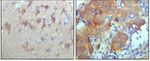 ErbB3 Antibody in Immunohistochemistry (Paraffin) (IHC (P))