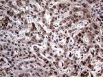 ERBB4 Antibody in Immunohistochemistry (Paraffin) (IHC (P))