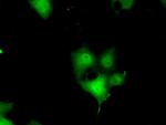 ERCC1 Antibody in Immunocytochemistry (ICC/IF)