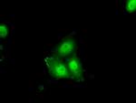 ERCC1 Antibody in Immunocytochemistry (ICC/IF)