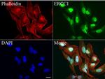 ERCC1 Antibody in Immunocytochemistry (ICC/IF)