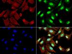 ERCC1 Antibody in Immunocytochemistry (ICC/IF)