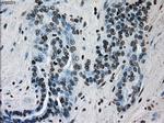 ERCC1 Antibody in Immunohistochemistry (Paraffin) (IHC (P))