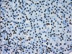 ERCC1 Antibody in Immunohistochemistry (Paraffin) (IHC (P))