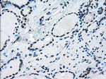 ERCC1 Antibody in Immunohistochemistry (Paraffin) (IHC (P))