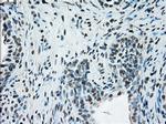 ERCC1 Antibody in Immunohistochemistry (Paraffin) (IHC (P))