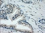 ERCC1 Antibody in Immunohistochemistry (Paraffin) (IHC (P))