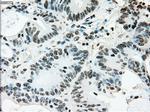 ERCC1 Antibody in Immunohistochemistry (Paraffin) (IHC (P))