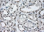 ERCC1 Antibody in Immunohistochemistry (Paraffin) (IHC (P))