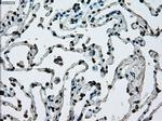 ERCC1 Antibody in Immunohistochemistry (Paraffin) (IHC (P))