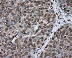 ERCC1 Antibody in Immunohistochemistry (Paraffin) (IHC (P))