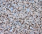 ERCC1 Antibody in Immunohistochemistry (Paraffin) (IHC (P))