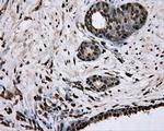 ERCC1 Antibody in Immunohistochemistry (Paraffin) (IHC (P))