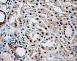 ERCC1 Antibody in Immunohistochemistry (Paraffin) (IHC (P))