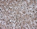 ERCC1 Antibody in Immunohistochemistry (Paraffin) (IHC (P))