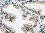 ERCC1 Antibody in Immunohistochemistry (Paraffin) (IHC (P))