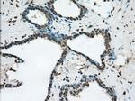 ERCC1 Antibody in Immunohistochemistry (Paraffin) (IHC (P))